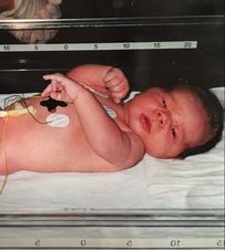 newborn after cesarean in Calgary