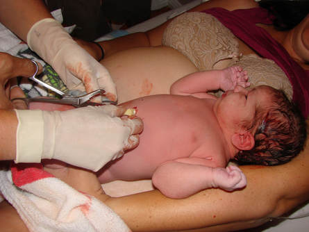 Cutting the umbilical cord